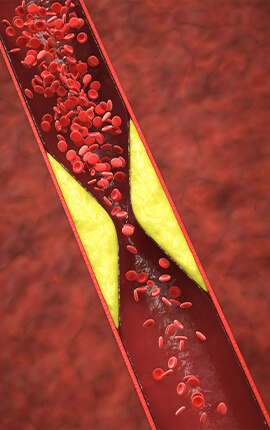 quelles-consequences-au-niveau-cardiovasculaire-laser-o-stop (1) Quelles conséquences au niveau cardiovasculaire ? Laser o stop